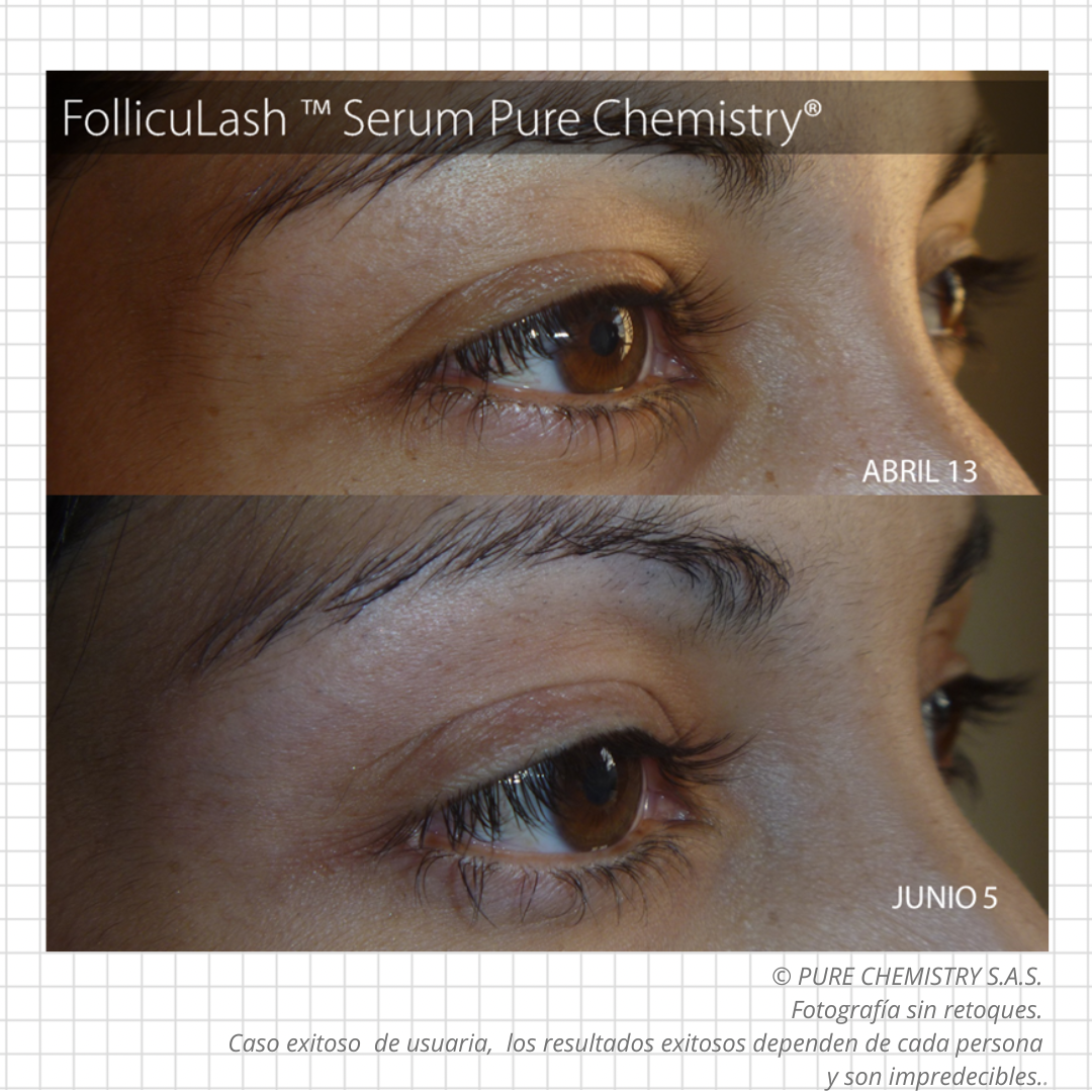 Folliculash® Serum x 10 gramos