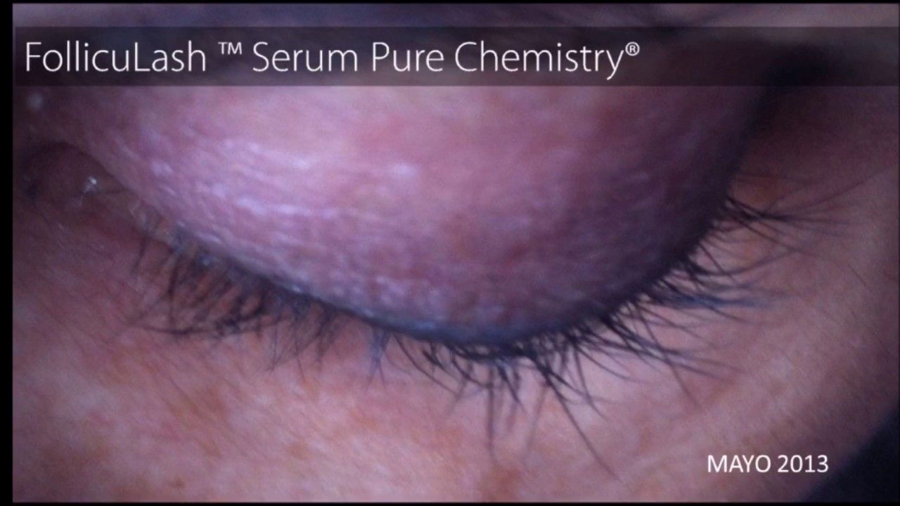 Folliculash® Serum x 10 gramos
