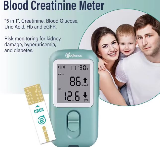 ANALIZZATORE EAGLENOS