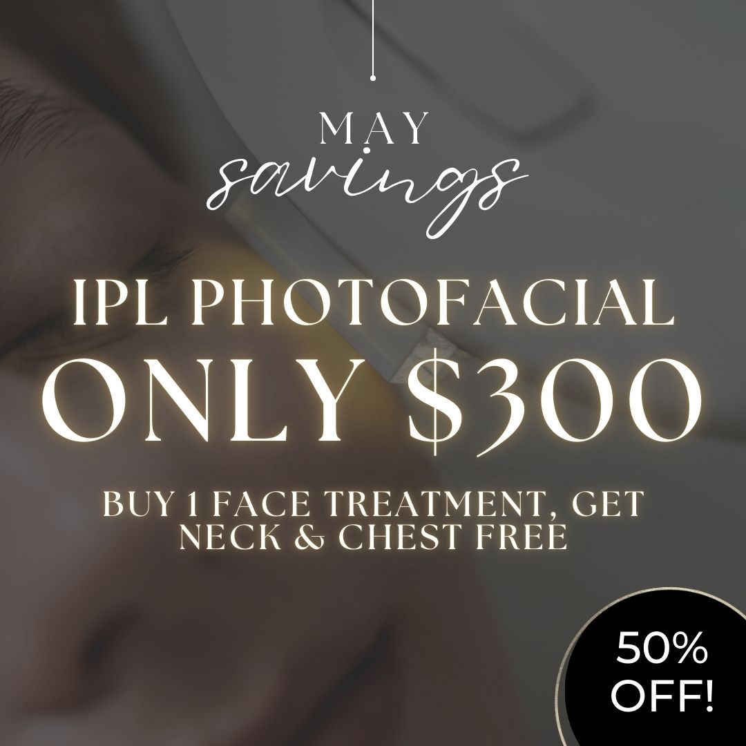 IPL Photofacial | Buy Face, Get Neck &amp; Chest FREE!