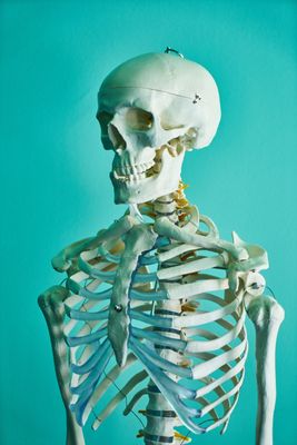 Dexa