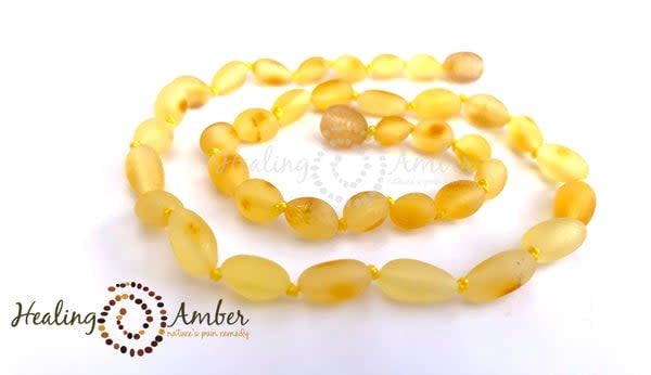 Healing Amber 15&quot; Necklace- Raw Gold Oval