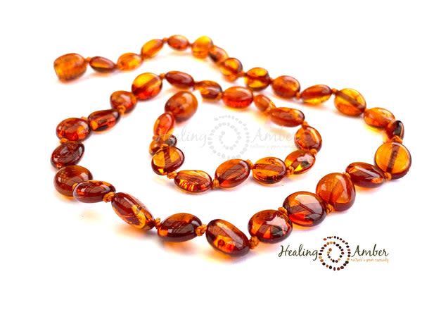 Healing Amber 15&quot; Necklace- Caramel Oval