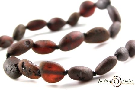 Healing Amber 18&quot; Necklace- Raw Molasses Oval