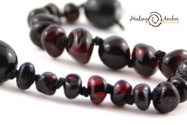 Healing Amber 15&quot; Necklace- Molasses