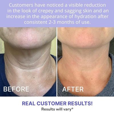 Neck Tightening Anti-Aging Cream