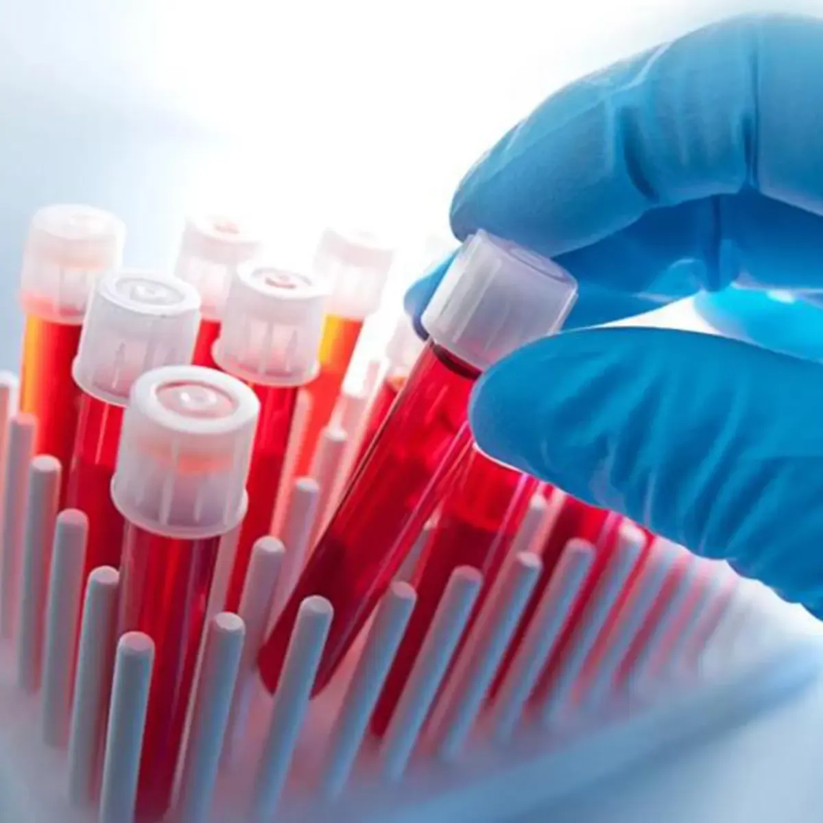 Male & Female Comprehensive Hormone Blood Panel