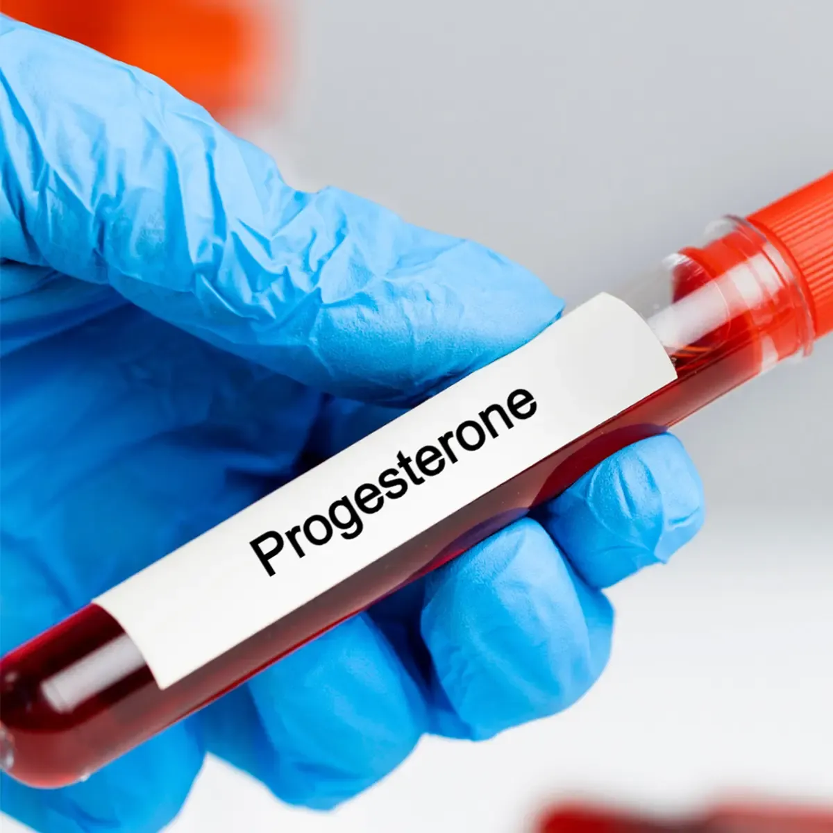 Progesterone Lab Test