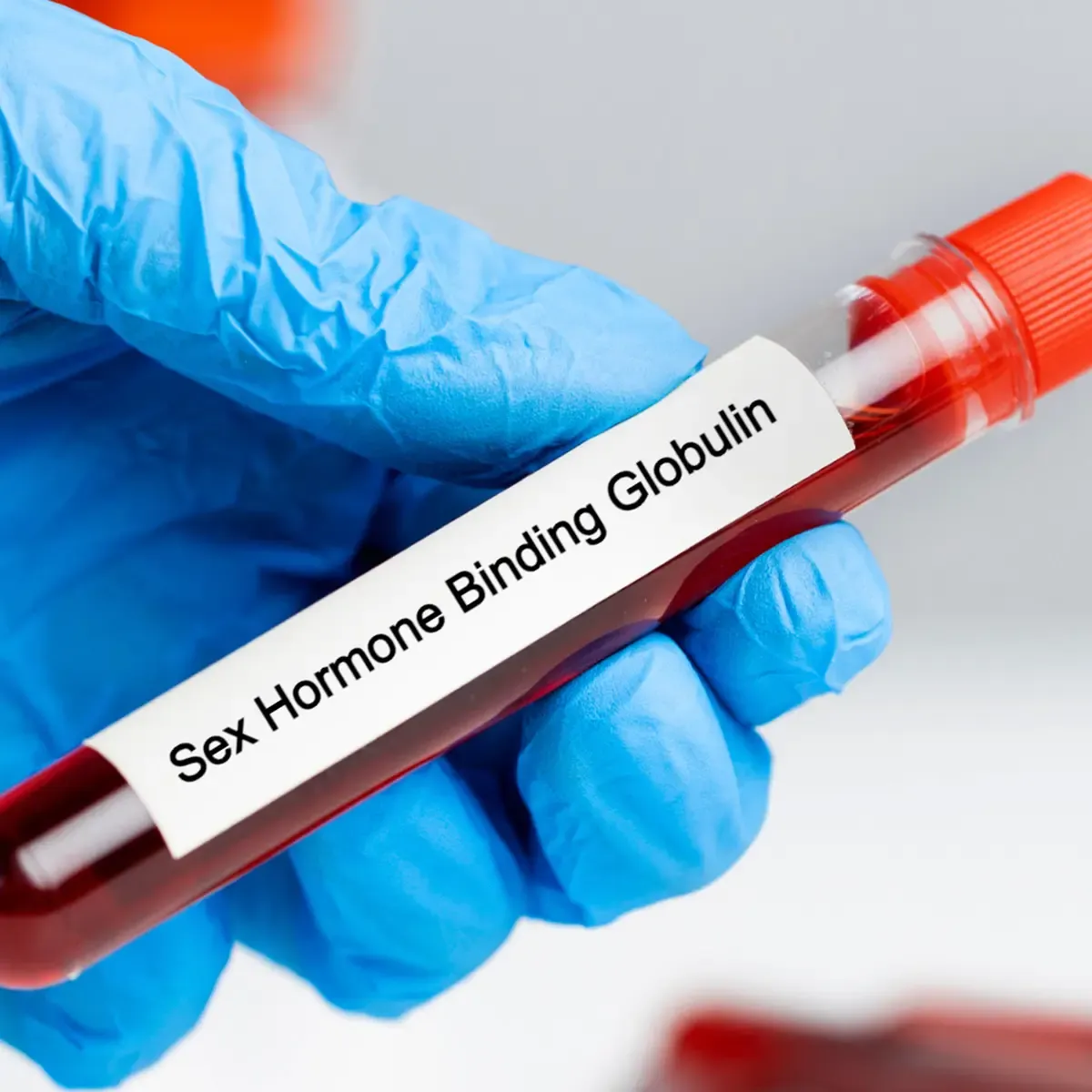 SHBG - Sex Hormone Binding Globulin Lab Test