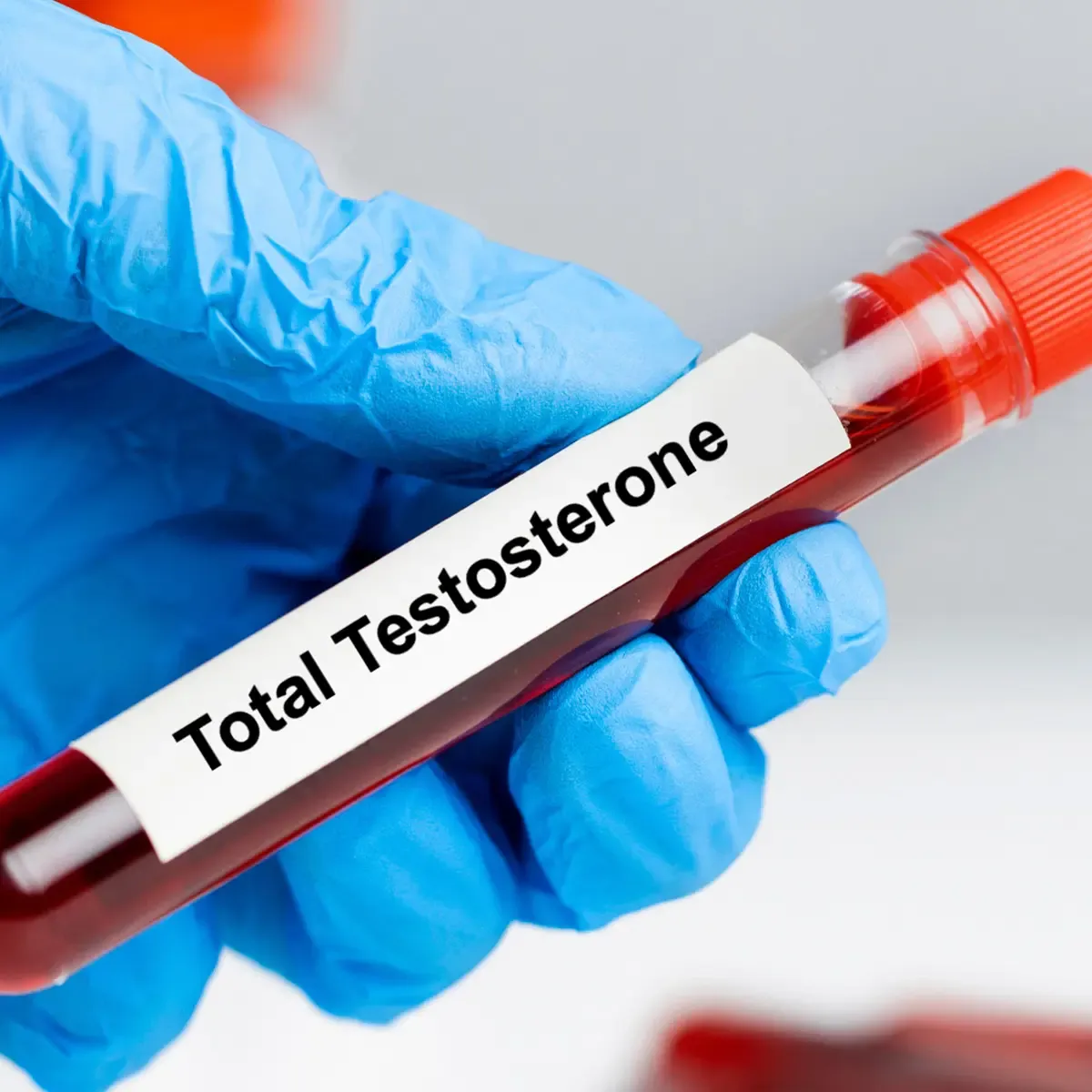 Total Testosterone Lab Test