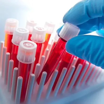 Specialized Lab Tests