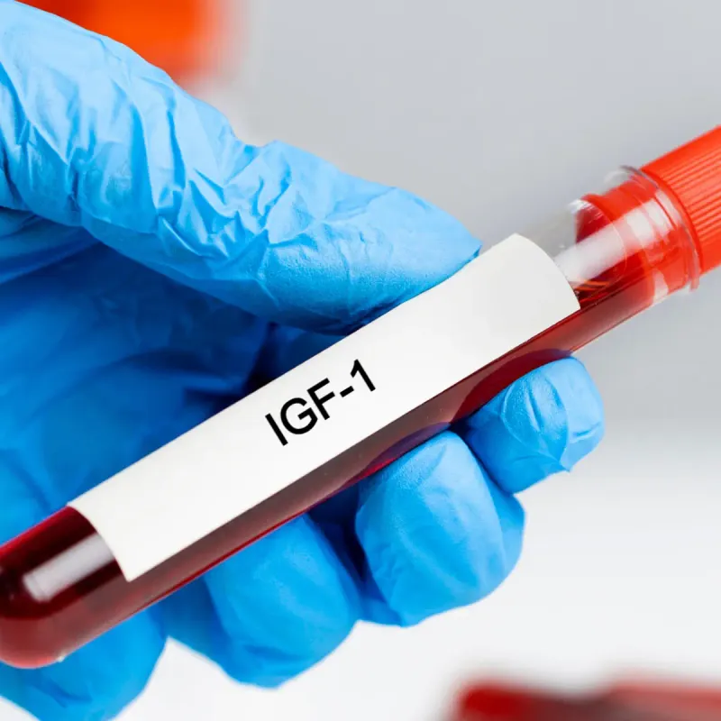 Growth Hormone (IGF-1) Lab Test