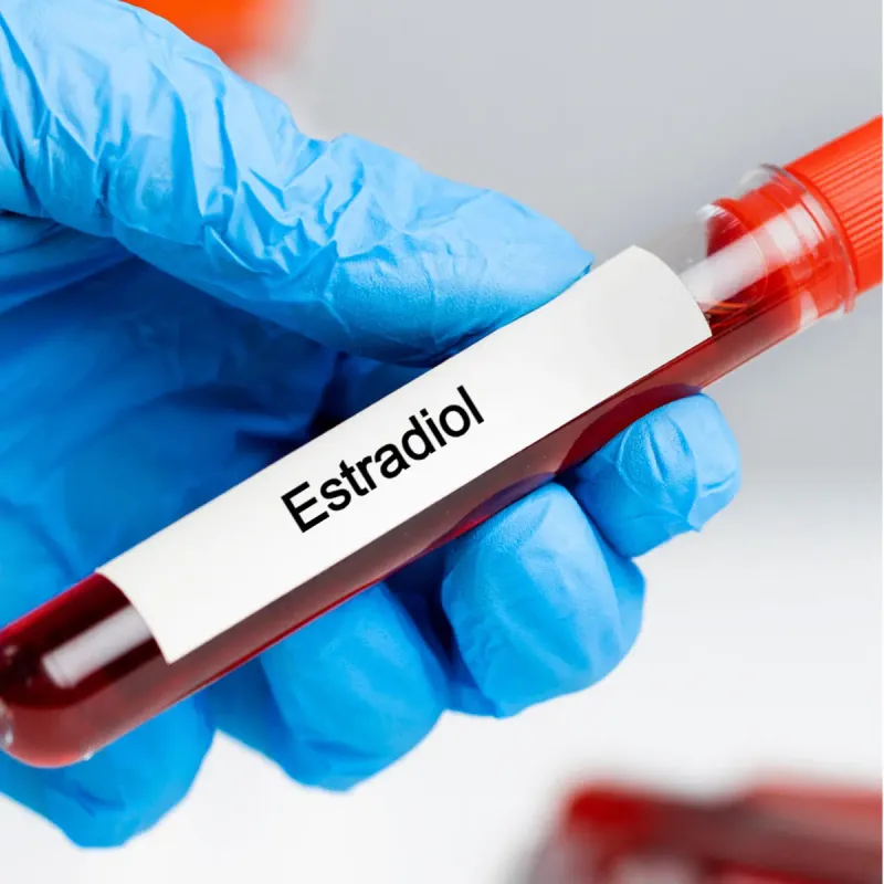 Estradiol (E2) Lab Test