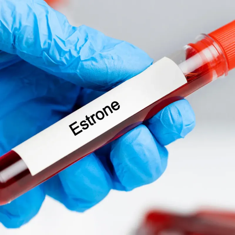 Estrone (E1) Lab Test