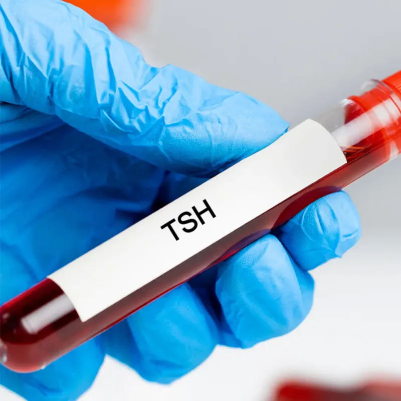 Thyroid Hormone Panel (TSH, free T3, free T4) Lab Test