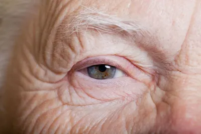 Pre-cataract operation eye examination assessment