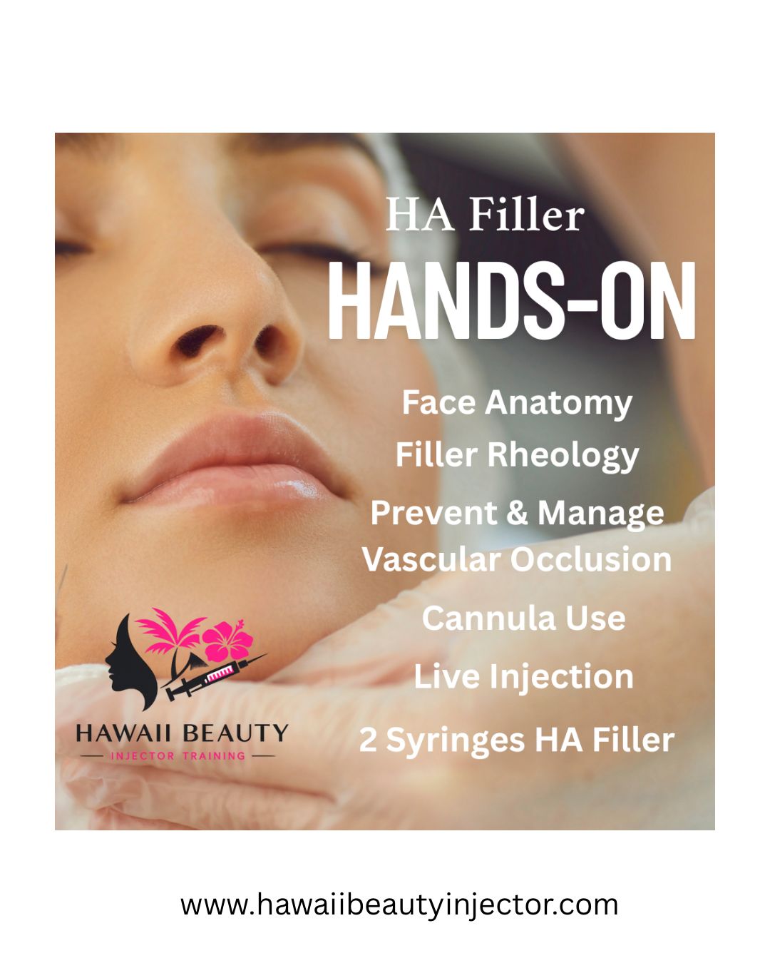 HA Filler &amp; Cannula