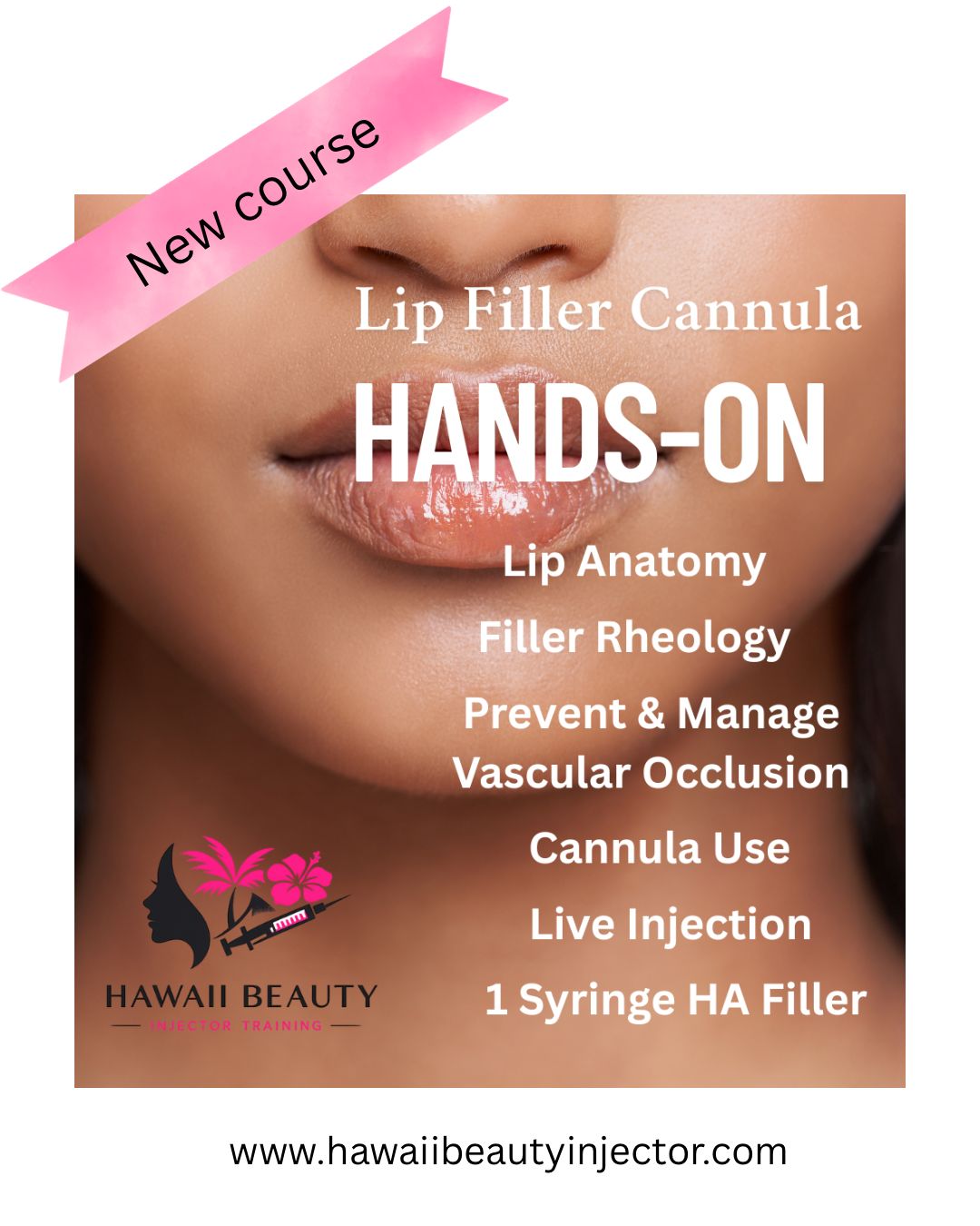 Lip Filler Cannula