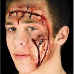 Prosthetics