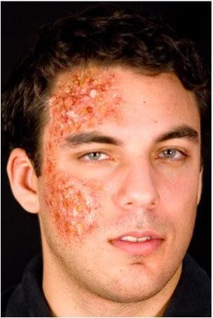 Infected Package