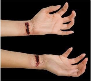 Slashed Wrist