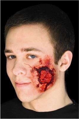 Open Wound w/Muscle Tissue