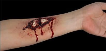 Broken Bone Pack