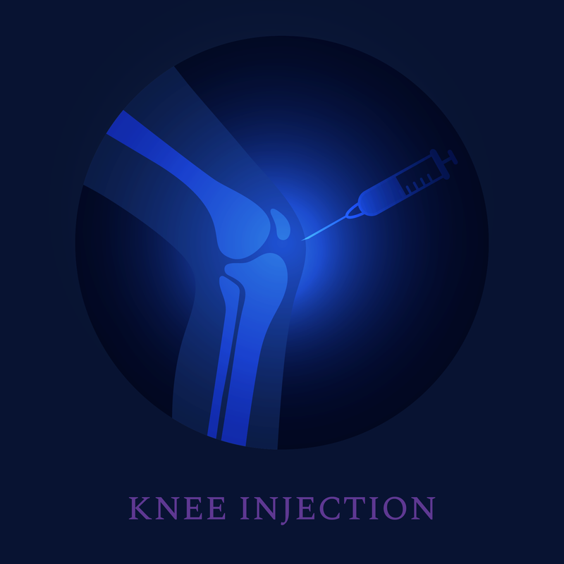 Knee Injection for Pain (Steroid)