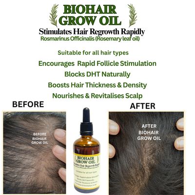 BIOHAIR Grow Oil for Rapid Hair Growth 100 ml