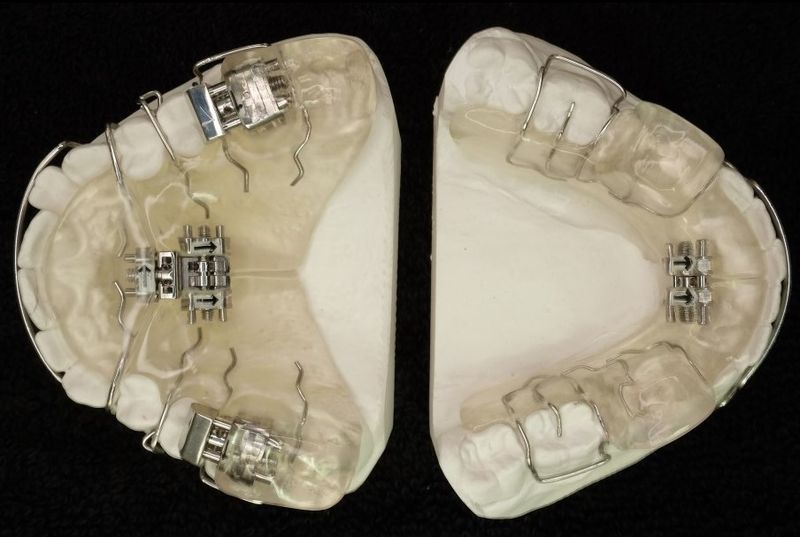 Twin Block modifiziert, konfigurierbar