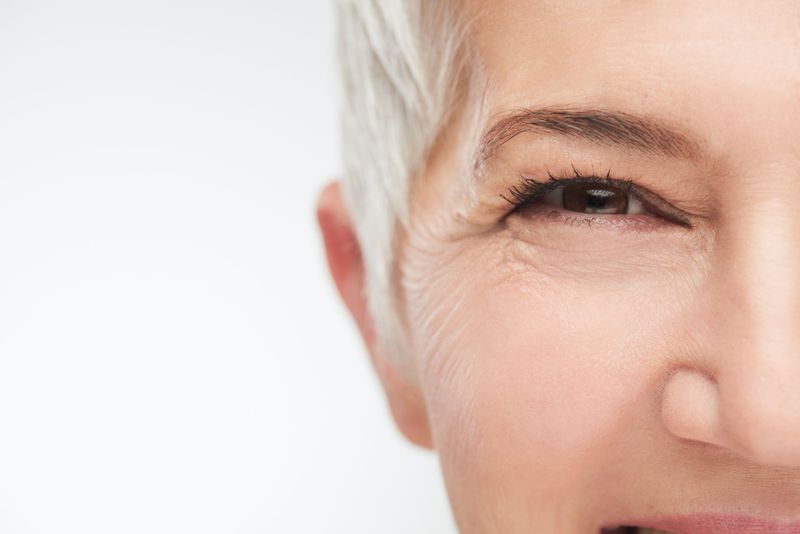 Soin des yeux au collagène avec endermolift LPG