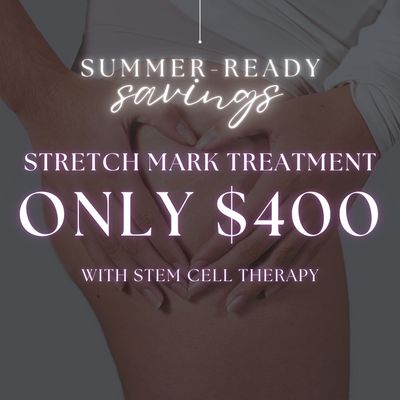 Stretch Mark Treatment | Anteage Stem Cell Therapy