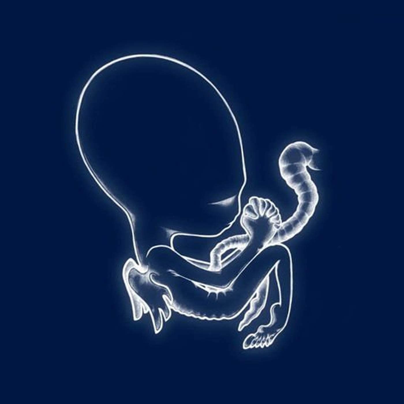 Sigur Ros - Agaetis Byrjun  (2021 Edition)