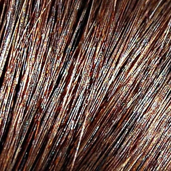 Micro-link/I-Tip #2