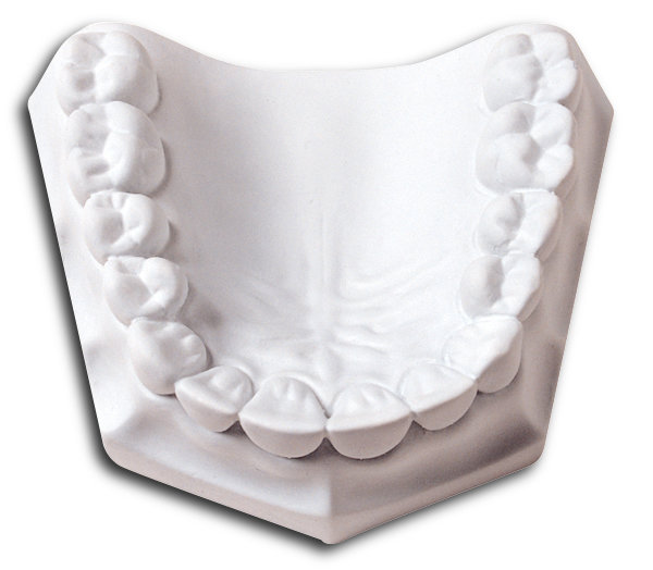 Whip Mix Super White Orthodontic Stone, 50 lb