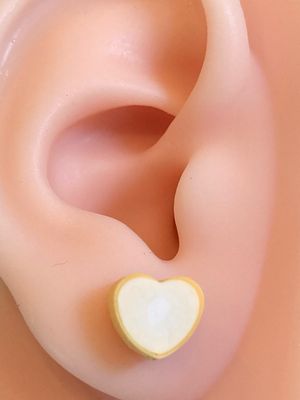 Yellow Glow Hearts