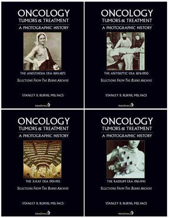 Oncology: Tumors & Treatment