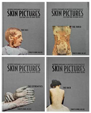 Skin Pictures: Masterpiece Photographs of  Nineteenth Century Dermatology
