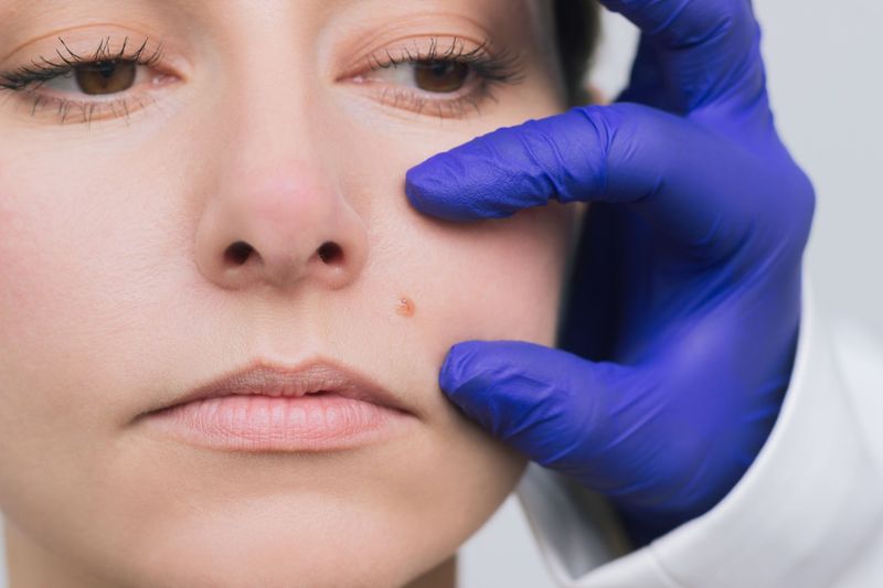 AGZ Collegium Fortbildung:  Dermatologie in der Hausarztpraxis