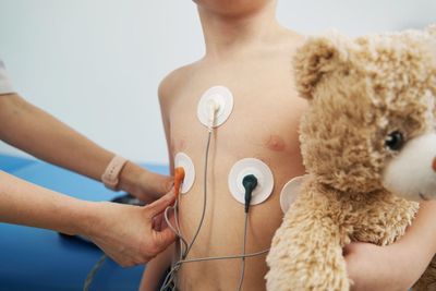 Holter de Ritmo