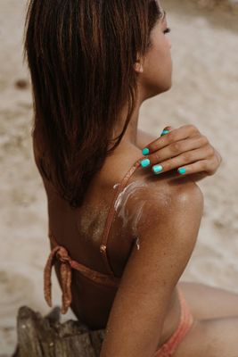 Sunburn