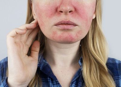 Sensitive & Redness-Prone Skin