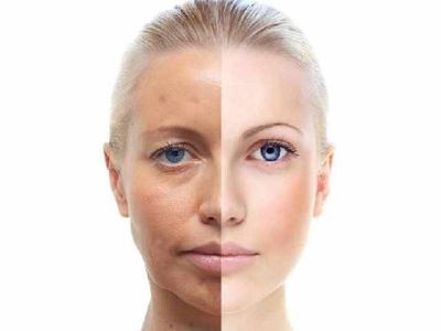 Firming & Tightening