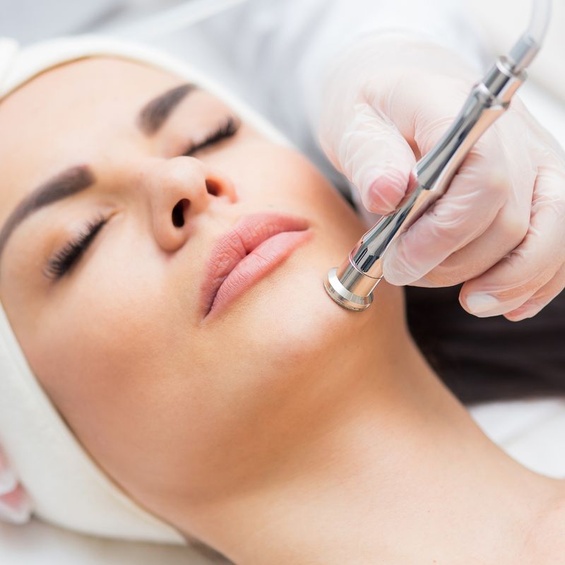 Microdermabrasie