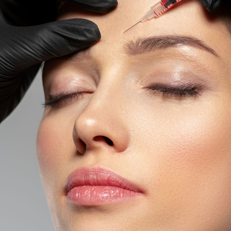 Botuline Toxine (Botox)