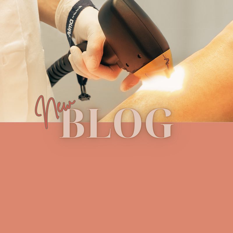 Alles wat je moet weten over laserontharing