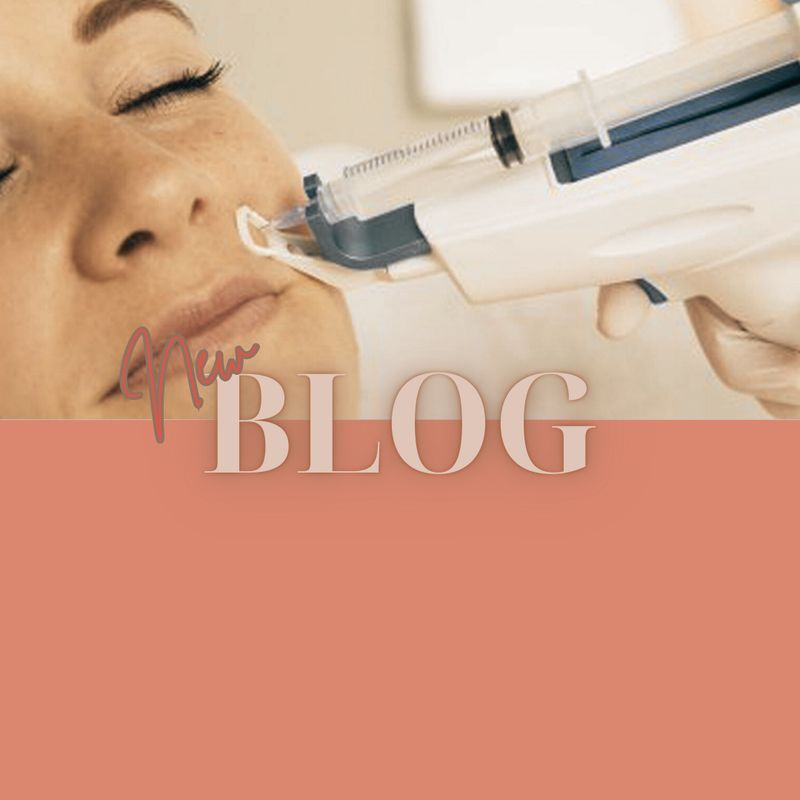 VIP-behandeling voor je huid: ontdek de kracht van mesotherapie en fillers