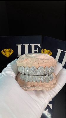 Custom Moissanite Grillz