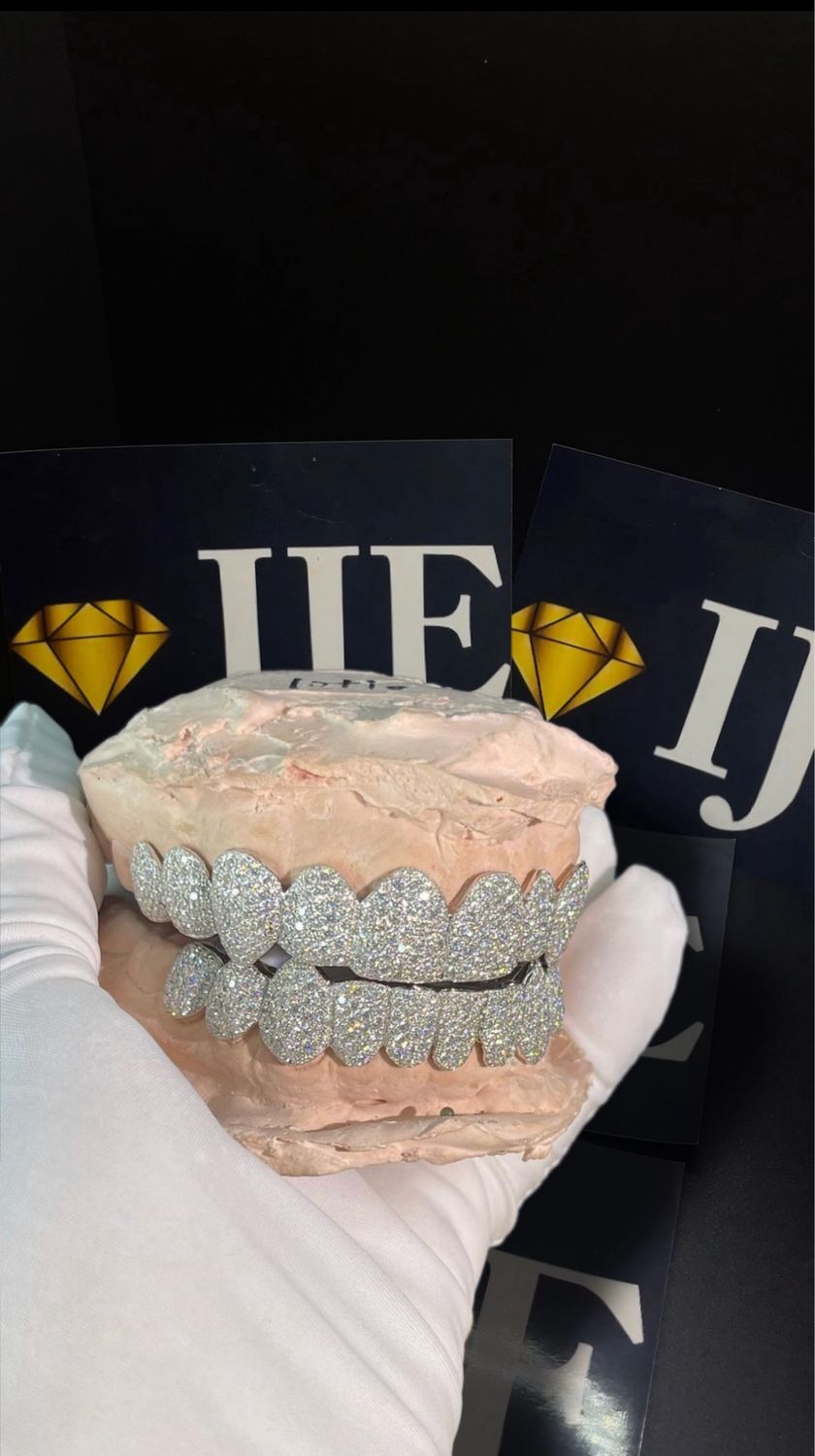 Custom Real Diamond Grillz
