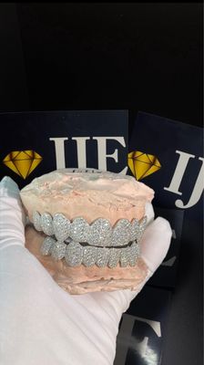 Custom Moissanite Grillz